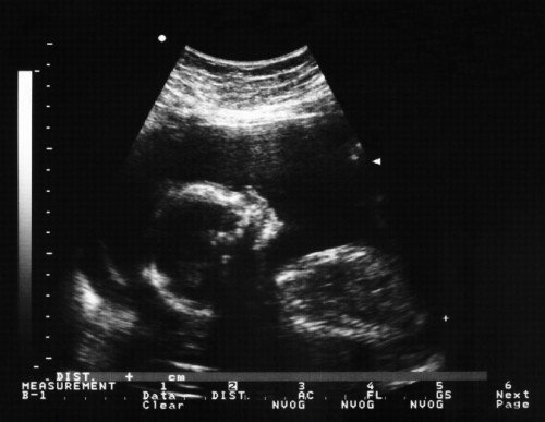 171014_140521_24740_2