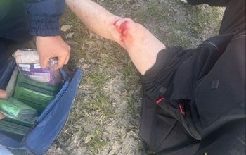 Водитель СИМ госпитализирован после столкновения с автомобилем на Заводском шоссе в Самаре